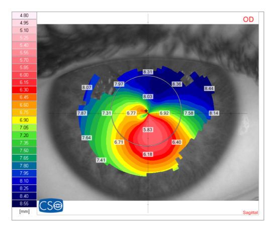 Lentes de contacto RPG